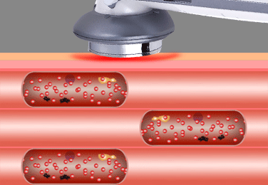 TB2.tqNXu_yQeBjy0FlXXczrXXa_!!1669671904