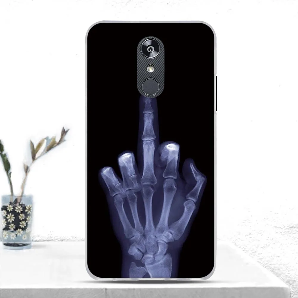 Чехол для LG Stylo 4/LG Q 4 чехол мягкий силиконовый из ТПУ Stylus +/Q Stylus/Stylo Plus чехлы