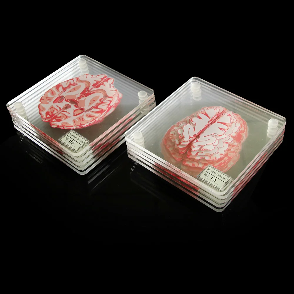 10Pieces/Set 3D Organ Brain Specimen Coasters Set Drinks Table Coaster Brain Slices Square Acrylic Glass  Drunk Scientists Gift