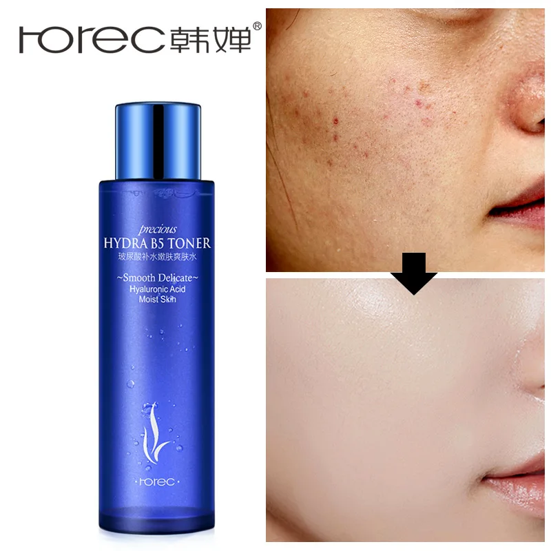 ROREC Hyaluronic Acid Face Whitening Toner Facial Acne Treatment Skin Care Moisturizing Remove Blackheads Oil-Control Essence ROREC Hyaluronic Acid Face Whitening Toner Facial Acne Treatment Skin Care Moisturizing Remove Blackheads Oil-Control Essence
