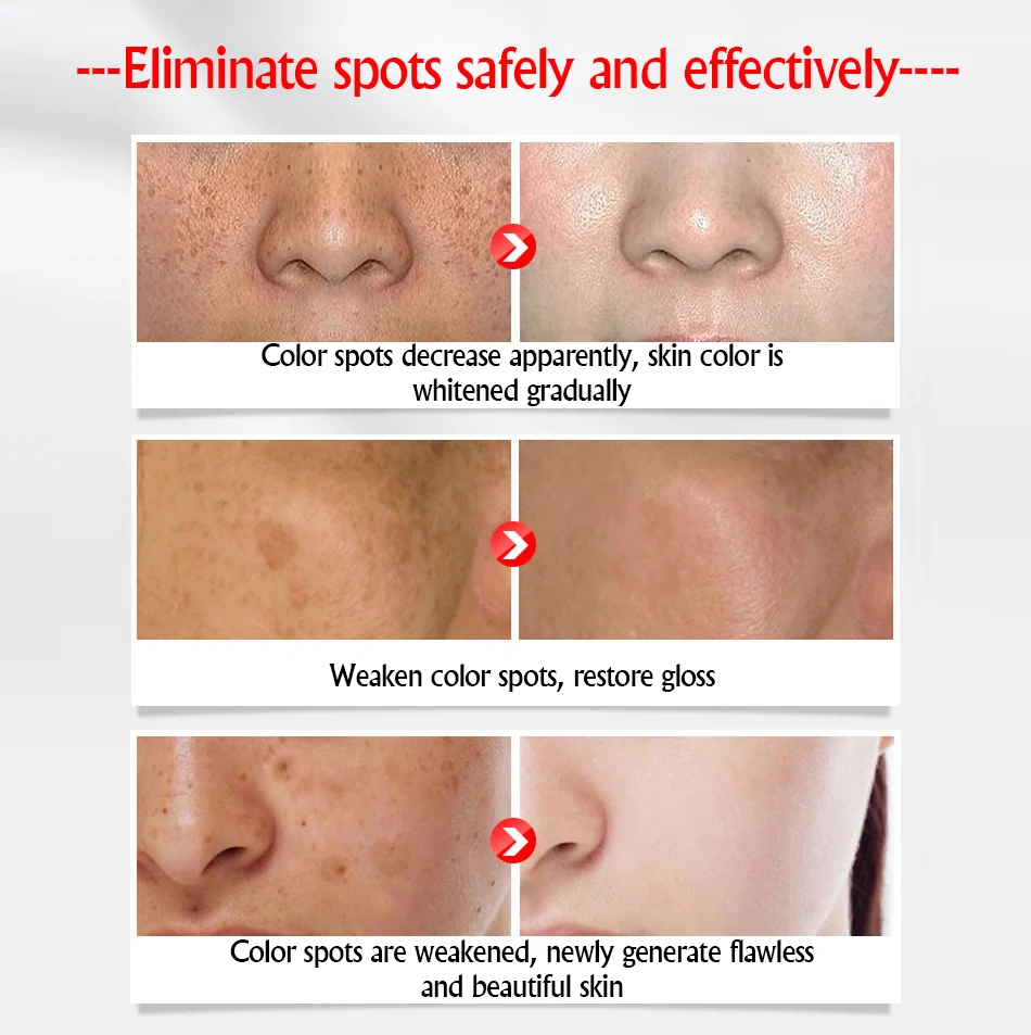 萃然美-祛斑美白霜_04