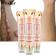 3PCS/LOT Acne Scar Stretch Marks Remover Cream Repair Face Cream Acne Spots Acne Treatment Blackhead Whitening Cream Skin Care chinese herbal face cream rosacea treatment red nose acne rosacea remover face cream redness flushing vaselines acne treatment