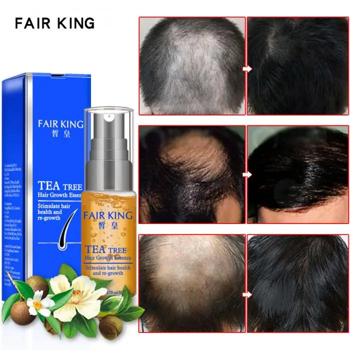 1 шт. эссенция для роста волос, предотвращающая выпадение волос, незаменимая жидкость, эффективный продукт для ухода 88