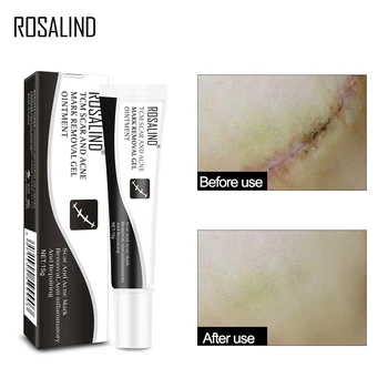 

ROSALIND Scar And Acne mark Removing Anti-Inflammatory And Repairing Skin Cream Ginseng Essence Skin Care Gel Ointment