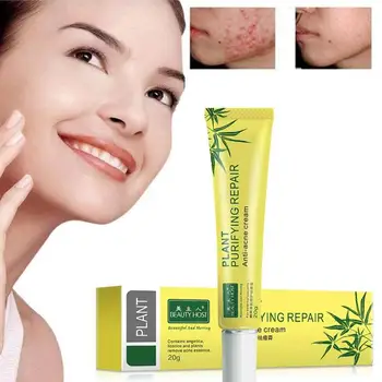 

20g Acne Scar Removal Cream Aloe Vera Gel Plant Extracts Cleansing Acne Cream Face Skin Care Spots Blemish Marks Treatment