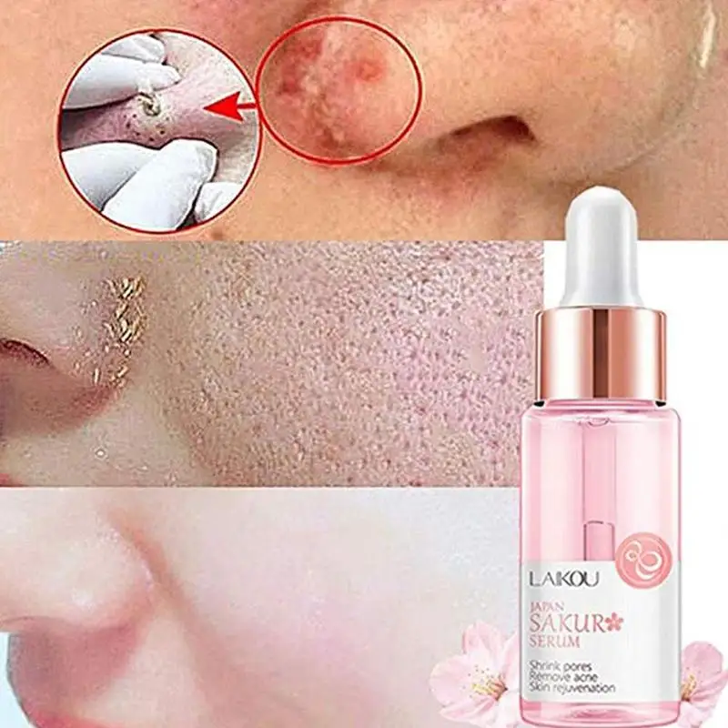 15ML Sakura Face Serum Shrink Pores Remove Acne Liquid Moisturizing Face Brighten Japan Skin Care Skin Serum