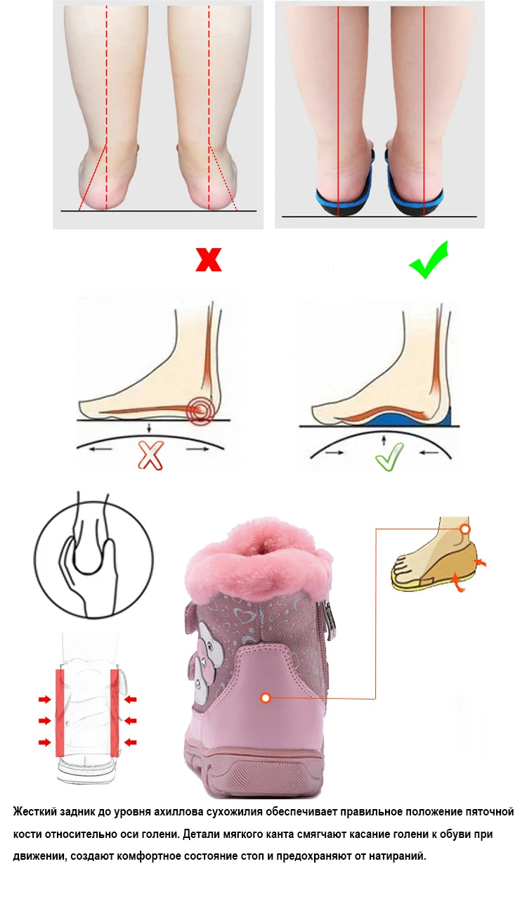 Princepard/100% натуральная меховая обувь из натуральной кожи для девочек, размеры 22-28, новинка 2018, розовая Зимняя ортопедическая обувь для детей