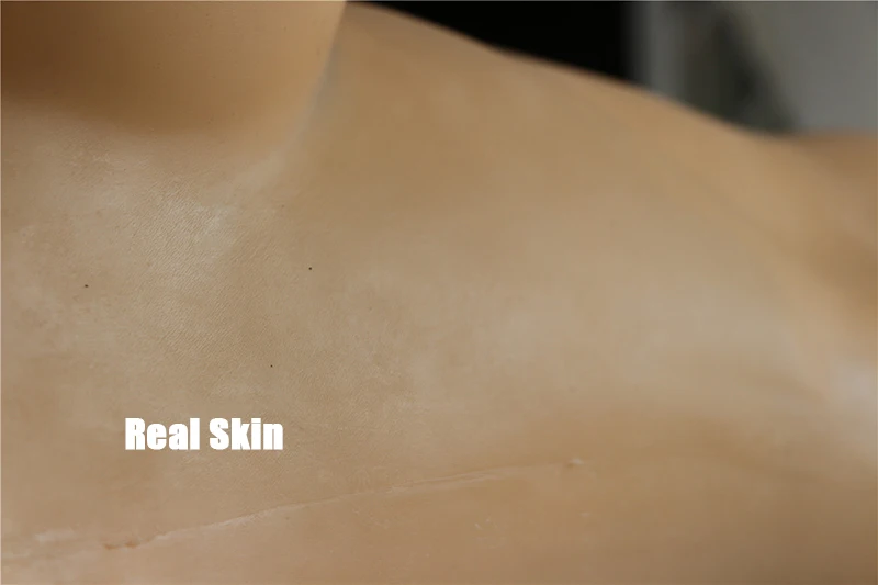 skin