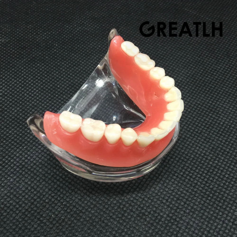 Зубные Overdenture Зубы Модель съемный интерьер нижние челюсти модель нижние челюсти с имплантатом для зуб обучения, изучения