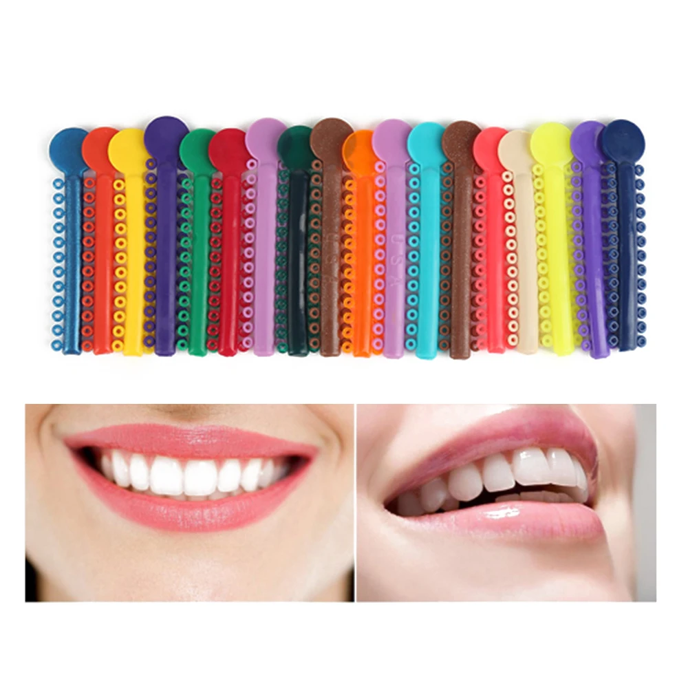 40 шт. стоматологические эластомерные Галстуки для лигатуры Ортодонтические эластичные резинки для ухода за зубами инструменты для ухода за полостью рта яркий цвет