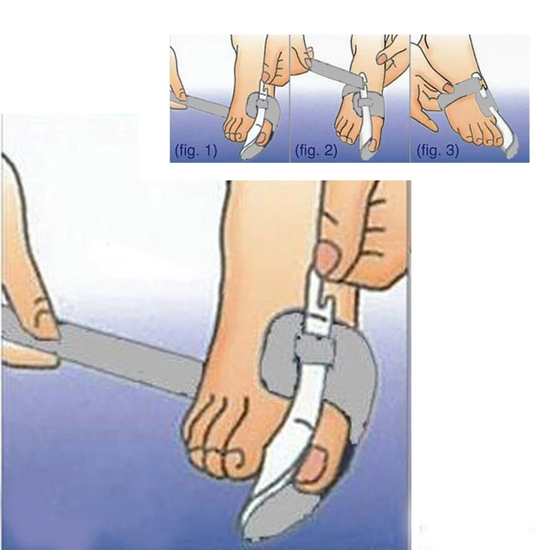 4 шт. = 2 пары Жук дробилка большой кости большого пальца стопы эктропион Пальцы внешний ортопедические Appliance Профессиональный Технология Разделители пальцев ног