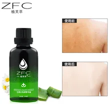 Отбеливающая и отшелушивающая эссенция, отшелушивающая кожу и отшелушивающая кожу