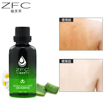 

Body Whitening And Exfoliating Essence Exfoliating Skin And Exfoliating Skin