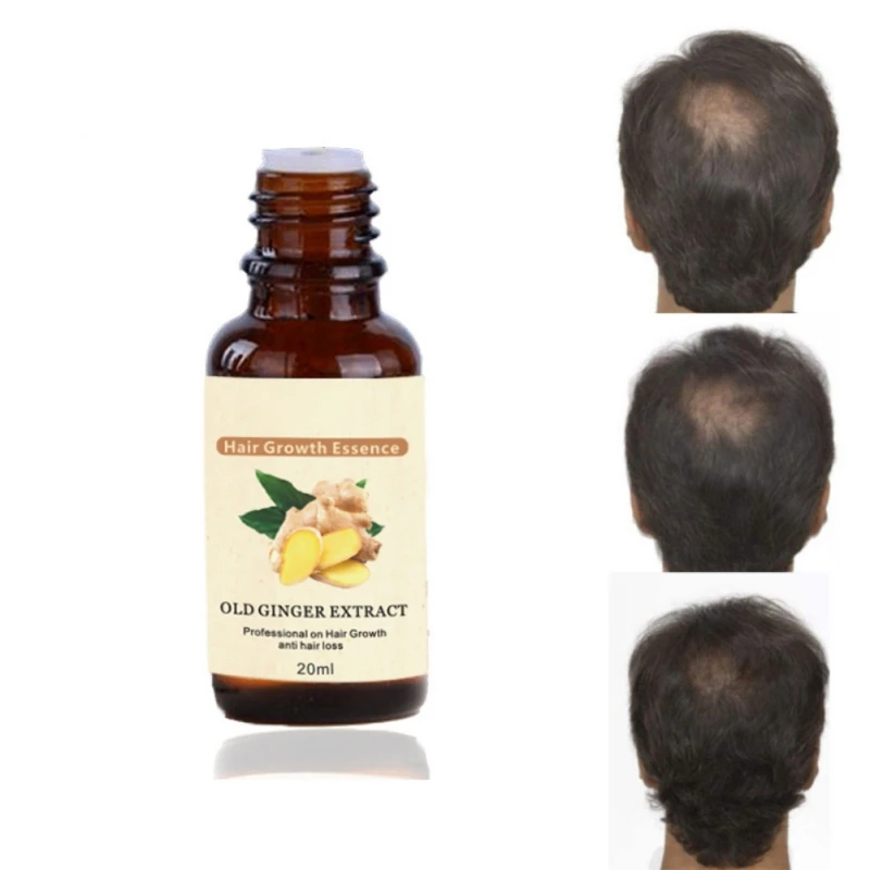 Hair Care Essential Oil Fast Hair Growth Essence Serum Repair