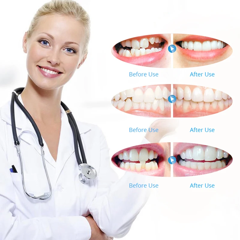 Permanent Retainer After Braces Cost