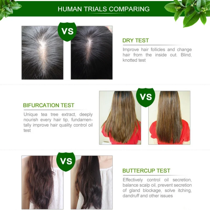 Чайное дерево натуральное 100% средство для роста волос питательное средство для кожи головы ускоряет рост волос сыворотка против выпадения
