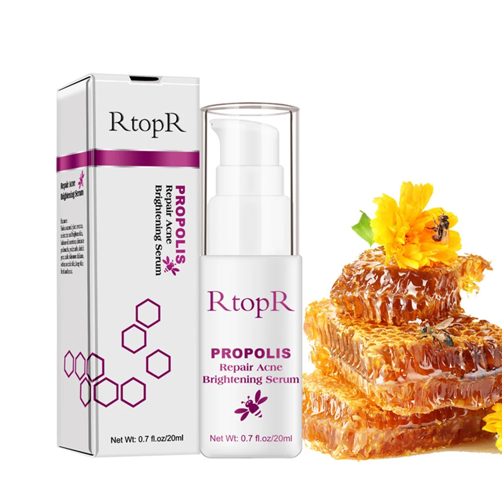 RtopR Propolis восстанавливающий крем против акне для постугревых рубцов осветляющая эссенция акне шрам эссенция усадка поры устранение акне TSLM1