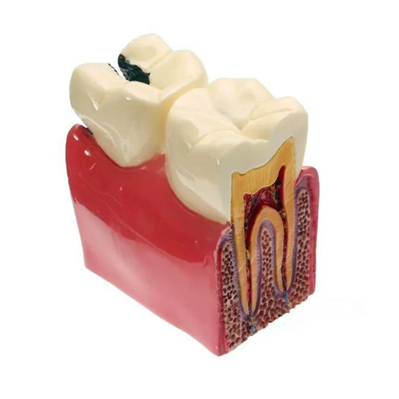 Различные стоматологические модели зубов используются для обучения и больничных стоматологов - Цвет: Цвет: желтый