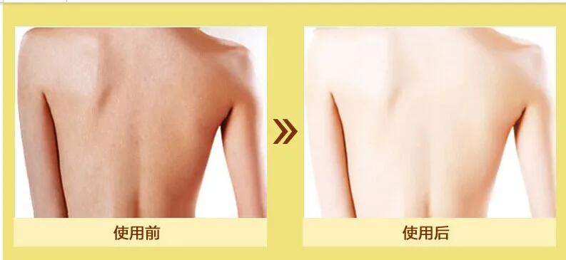 Image result for BODY BEFORE AFTER WHITENING