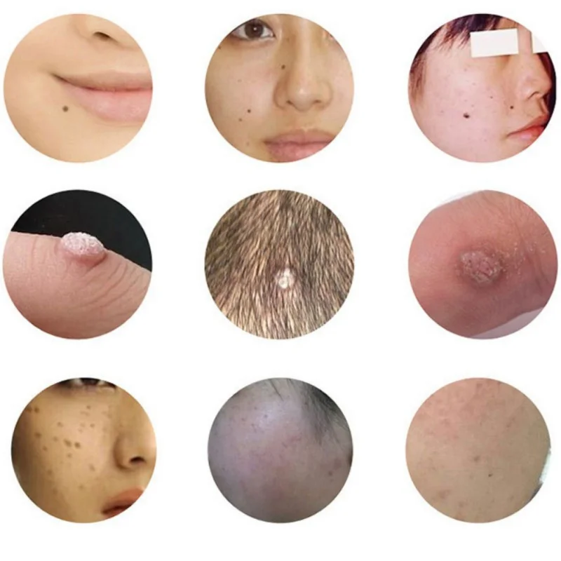 HTB1mnANSFXXXXXAXFXXq6xXFXXXA