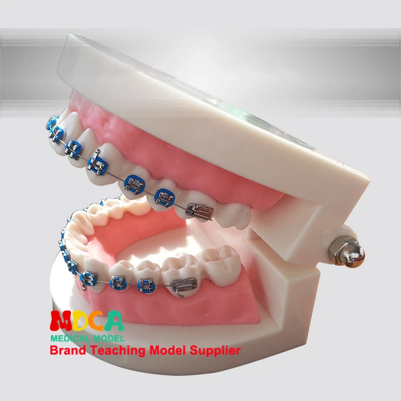 Модели зубов, стоматологические материалы, вспомогательные средства, ортодонтия обучения стоматологии MYC003