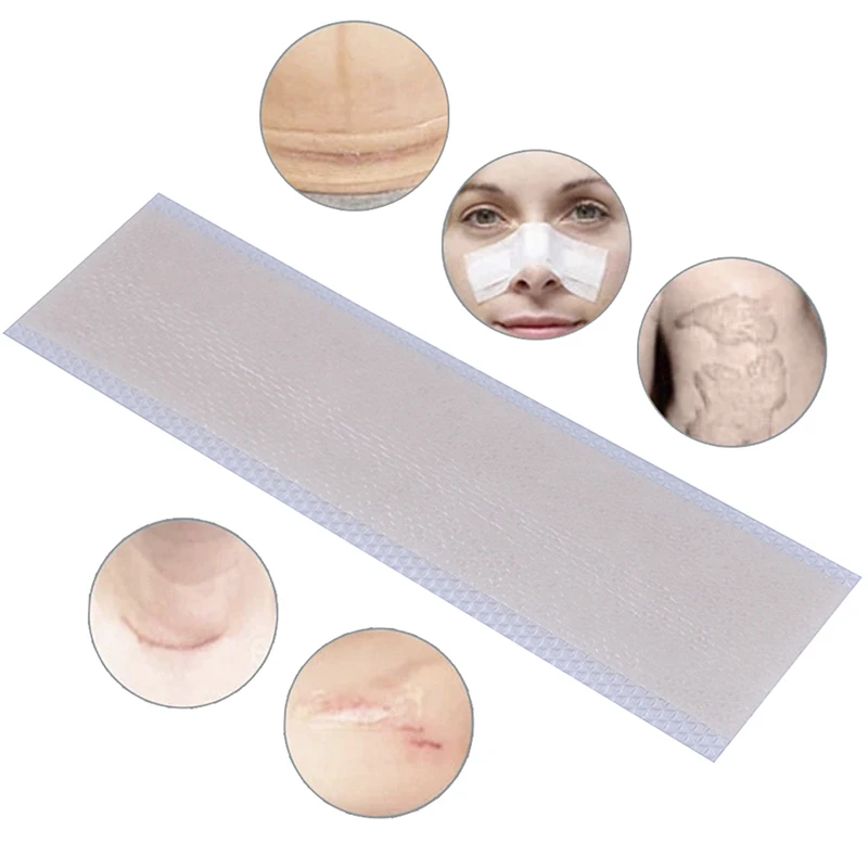 

1pc Silicone Scar Removal Patch Remove Trauma Burn Scar Sheet Skin Repair Scar Removal Therapy Patch for Acne Scar Treatment