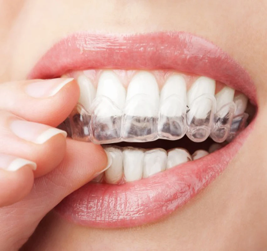 

2 Pairs / 4 pieces Thermoforming Dental Mouthguard Teeth Whitening Trays Bleaching Tooth Whitener Mouth Guard Care Oral Hygiene