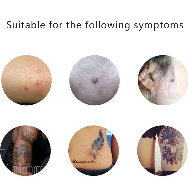 Mole-Needle(1)