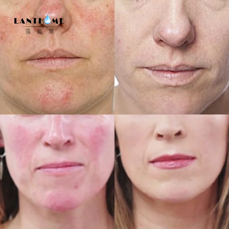 cakeless concealer benefit