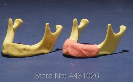 ENOVO The training model of oral cavity dental implant training was used to simulate mandibular artificial dental implant train ENOVO The training model of oral cavity dental implant training was used to simulate mandibular artificial dental implant train