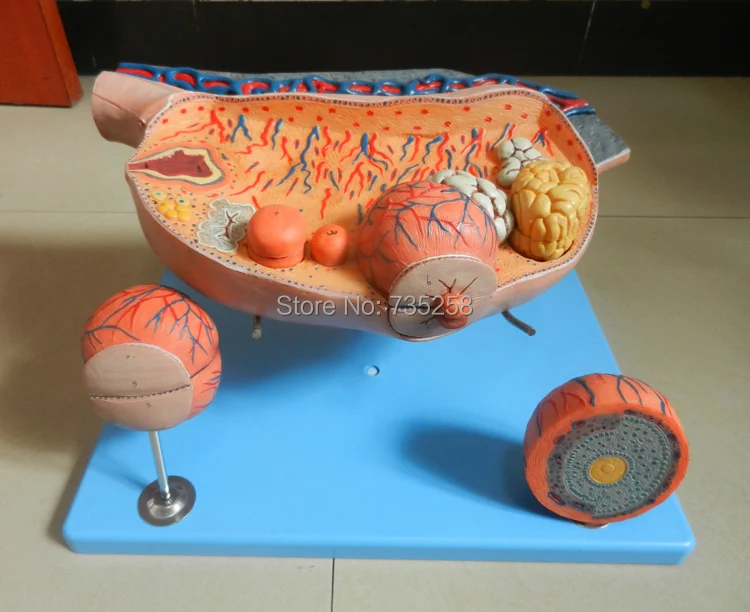 Enlarged Ovary,Women Ovarian Enlargement Model ,The Ovaries Anatomical