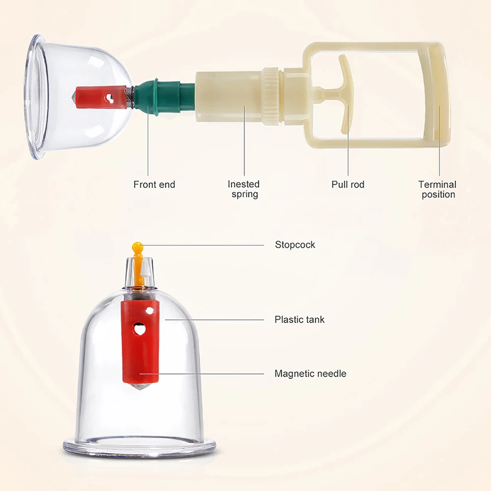 Yuwell 6 Can китайские традиционные вакуумные баночки для массажа толстые магнитные аспирационные банки для вакуумного массажа массаж иглоукалыванием отсасывающая чашка