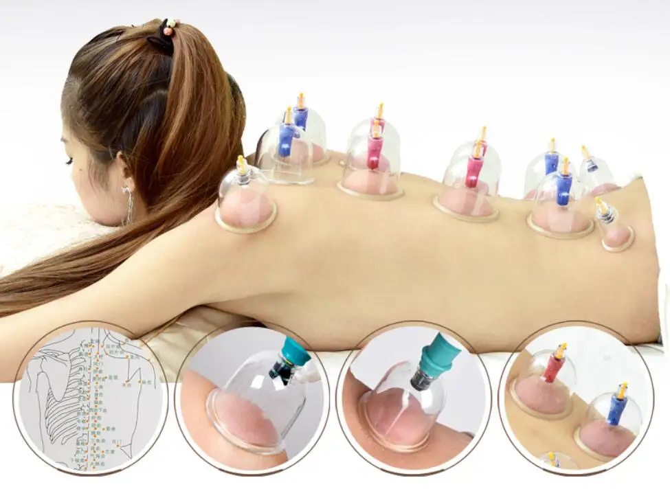 

Vacuum cupping device 12/24/32/40 cans