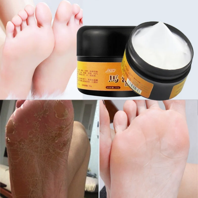 Horse Oil Foot Hand Antifreeze Cream Treatment Dry Skin Heel Chapped Peeling Repair Beauty Skin Care Products