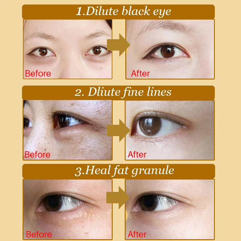 5pairs=10pcs Crystal Collagen Eye Mask Dark Circle Remover Anti-Wrinkle Whey Protein Eye Patches Under the Eyes for Face Mask -
