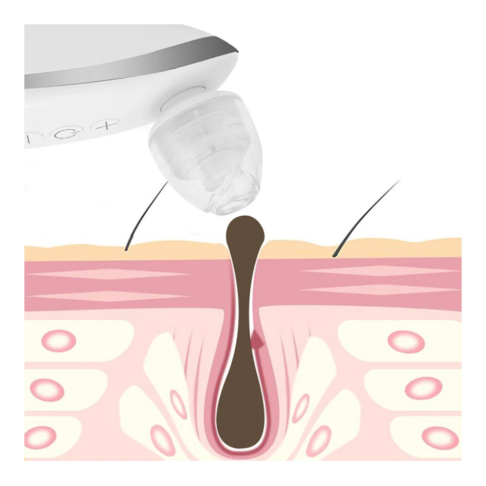  Blackhead Remover for Face Acne Pimple Remover Tool Blackhead Extractor Pore Cleaner Vacuum Suction