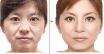 

free shipping 20pairs Anti-Puffiness cosmetic eye patch moisture Soothing Tired Eyes eye mask for puffy eyes