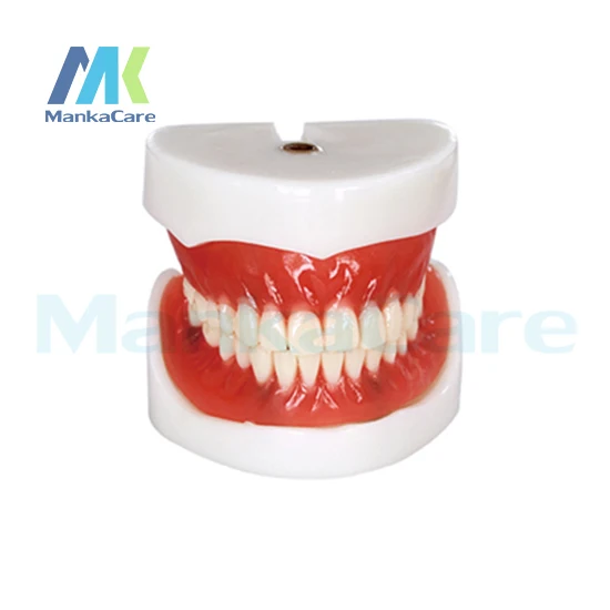 Manka Care - Full Denture Implant Mode Oral Model Teeth Tooth Model