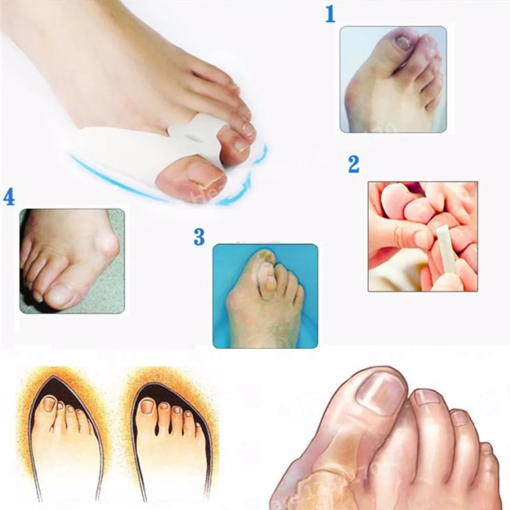 

Medical Silicone Gel Big Toe Separator New Air-vent Foot Hallux Valgus Correct Bunion Protector Pain Guard Feet Care T116OLE