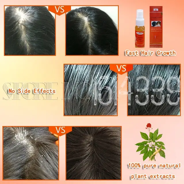 3pc Natural Hair Loss Alopecia Areata Treatment Hair Regrowth Oil