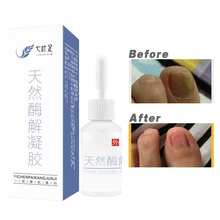 Профессиональные Травы ногтей антибактериальные масло для ногтей ремонт также противогрибковые Осветляющий палец удаление грибка Уход за ногтями масло