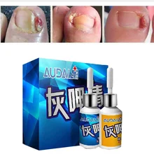 2 шт грибковое Лечение ногтей, эссенция отбеливание ногтей и ног, удаление грибка ногтей, отбеливание Onychomyco, уход за ногами, гель для ногтей, инструменты