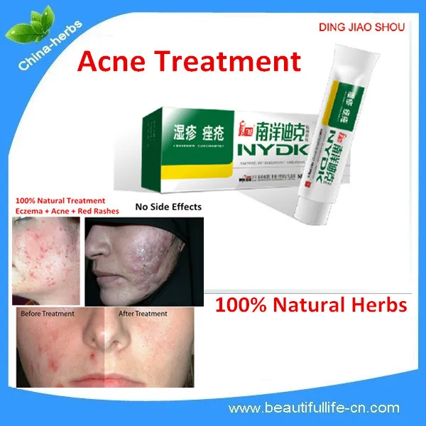 2 Pieces Anti bacteria Gel Anti Acne Anti Eczema Natural Gel Kill