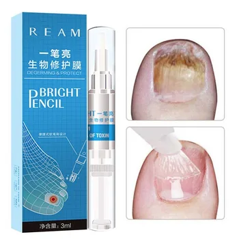 

Anti Fongique Infection Nail Bright Pencil Fungal Treatment Anti Fungus Biological Repair 3ml Restores Healthy Nail Free Ship