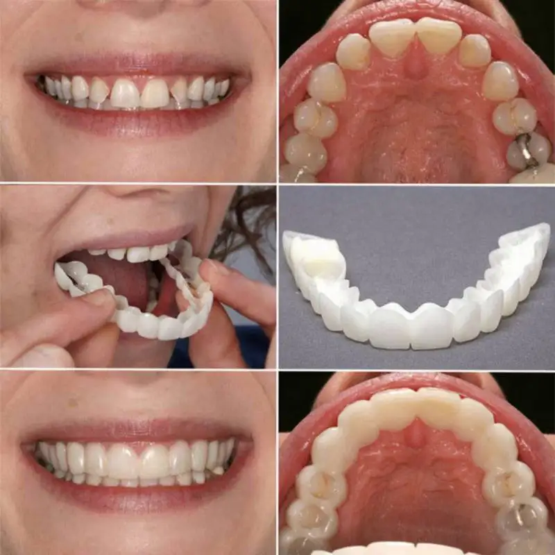 

Veneers Teeth Comfort Fit Flex Cosmetic Teeth Denture Teeth Top Cosmetic Veneer Simulation Braces