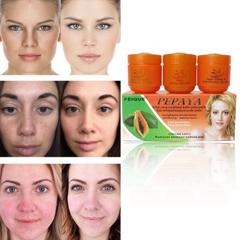 1/2/3pcs Papaya Whitening Creams Set Face Whitening Essence Moisturizing Dilute Freckles Lightening Pigment Freckle Remove