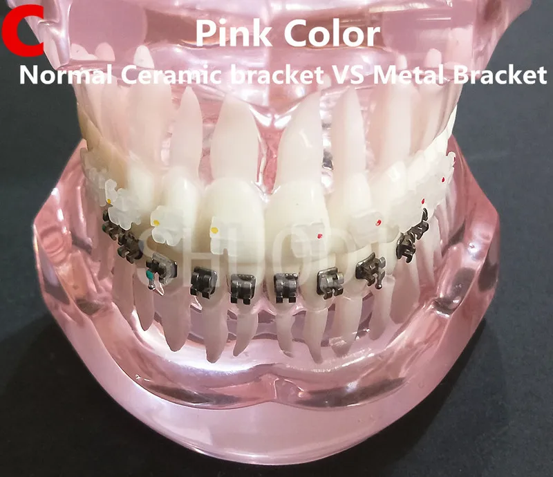 Стоматологический уход за полостью рта модель зубов Стоматологическая Ортодонтическая модель для связи пациента Стоматологическая модель исследования - Цвет: 1 piece C