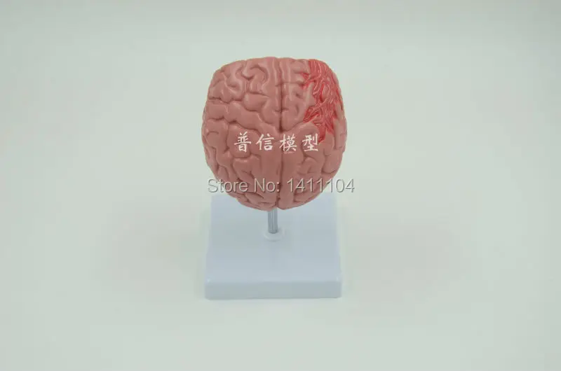 Купить Человеческий мозг анатомическая модель, апоплексический удар ...