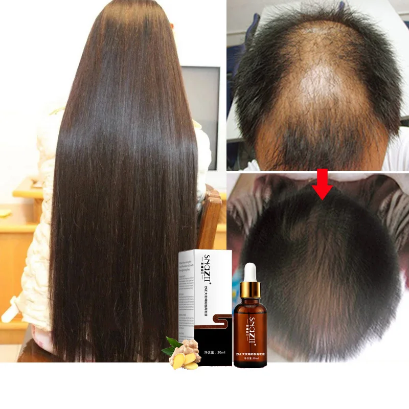 Snazii, масло имбиря для роста волос, натуральная растительная эссенция, более быстрый рост бороды, ресницы, тонизирующий шампунь для волос, сыворотка для ухода за волосами