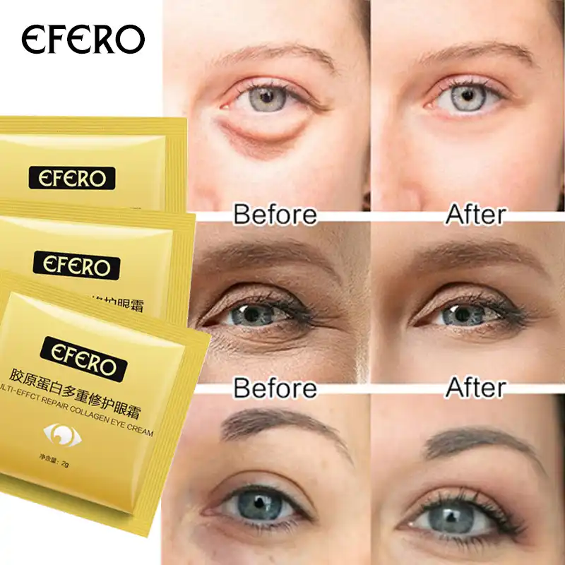 ointment for eye bags